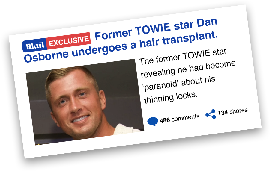 Dan Osborne Article - Hair Transplant Treatment - British Hair Clinic