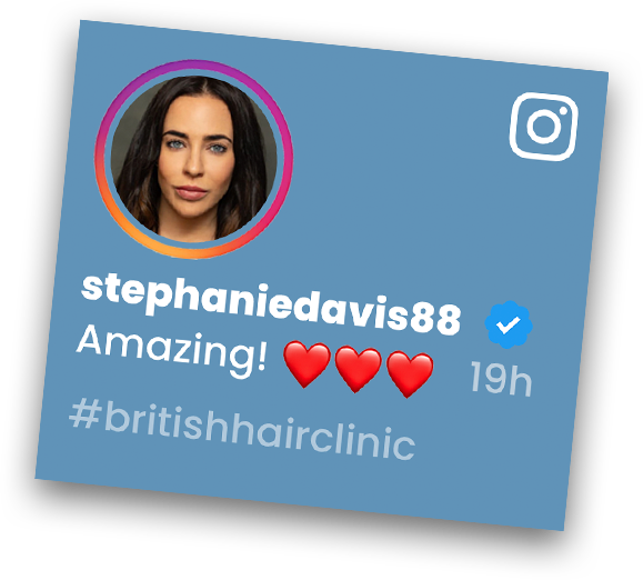 Stephanie Davis Article - Hair Transplant Treatment - British Hair Clinic