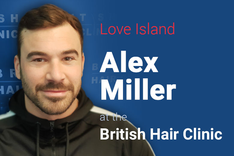 Alex Miller - British Hair Clinic - Hair Transplant