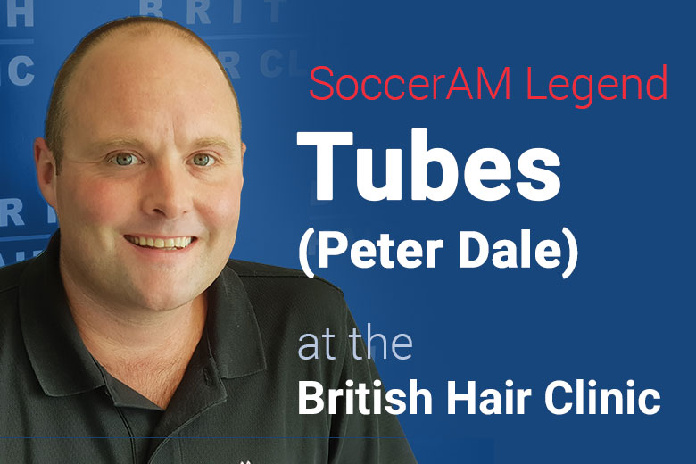 SoccerAM Tubes - Peter Dale - British Hair Clinic