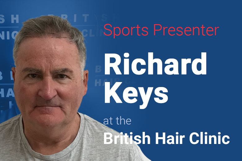 Richard Keys - Hairline Transplant - British Hair Clinic