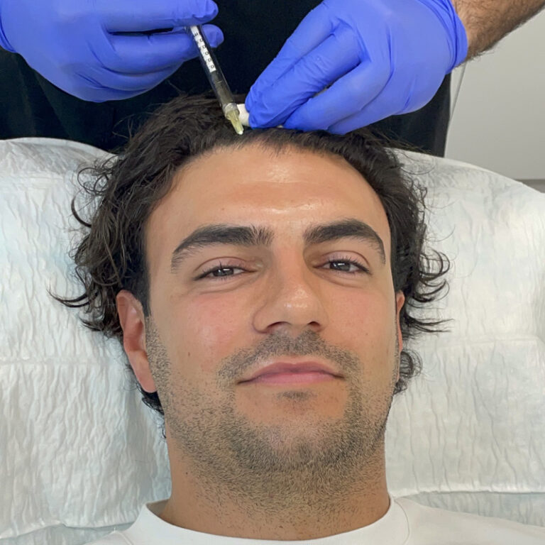 Ercan Ramadan | Essex | British Hair Clinic