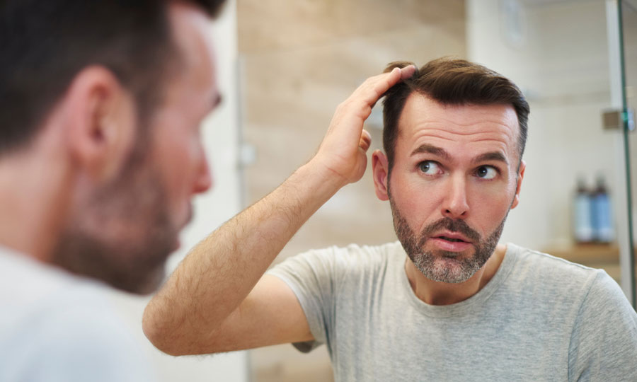 How does a hair transplant look after 10 years? - British Hair Clinic